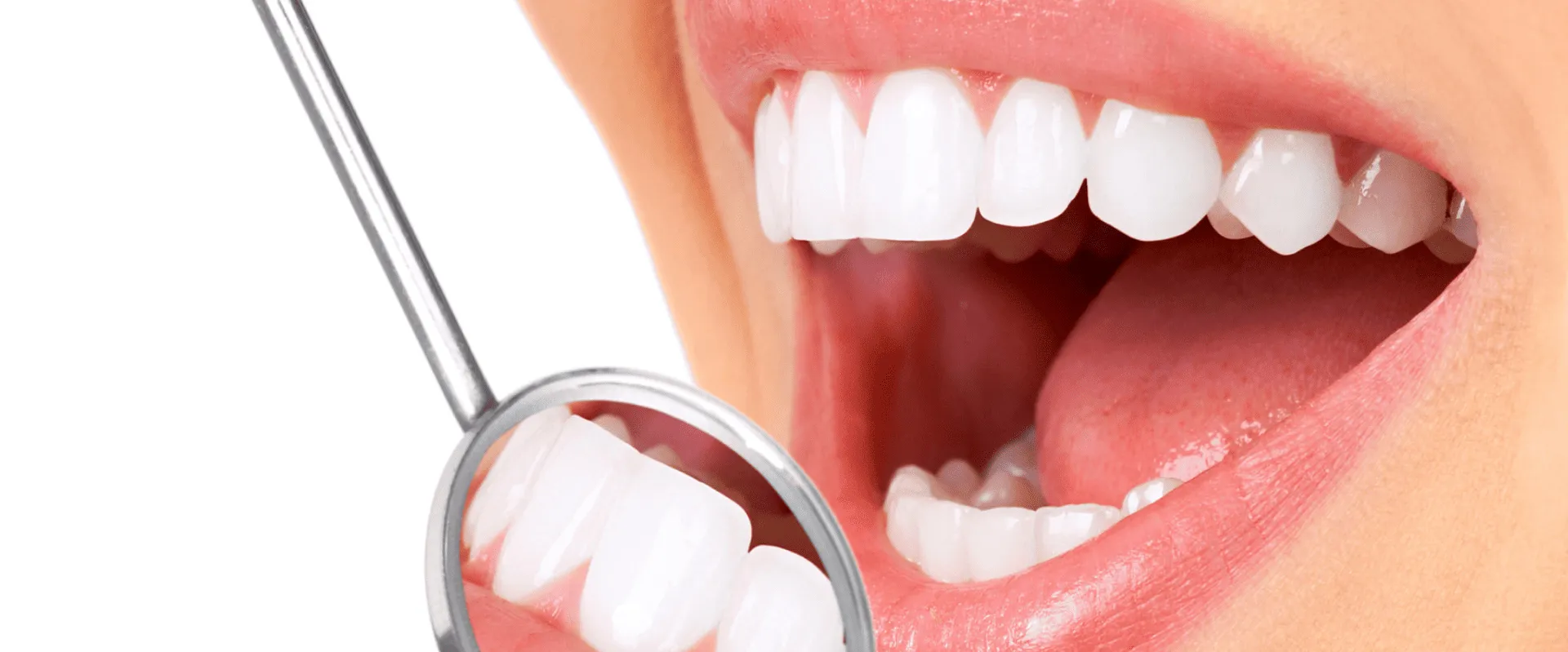 Dra. Rúbia Lorena - Dentista em Goiânia - Postagem no Blog - 0001