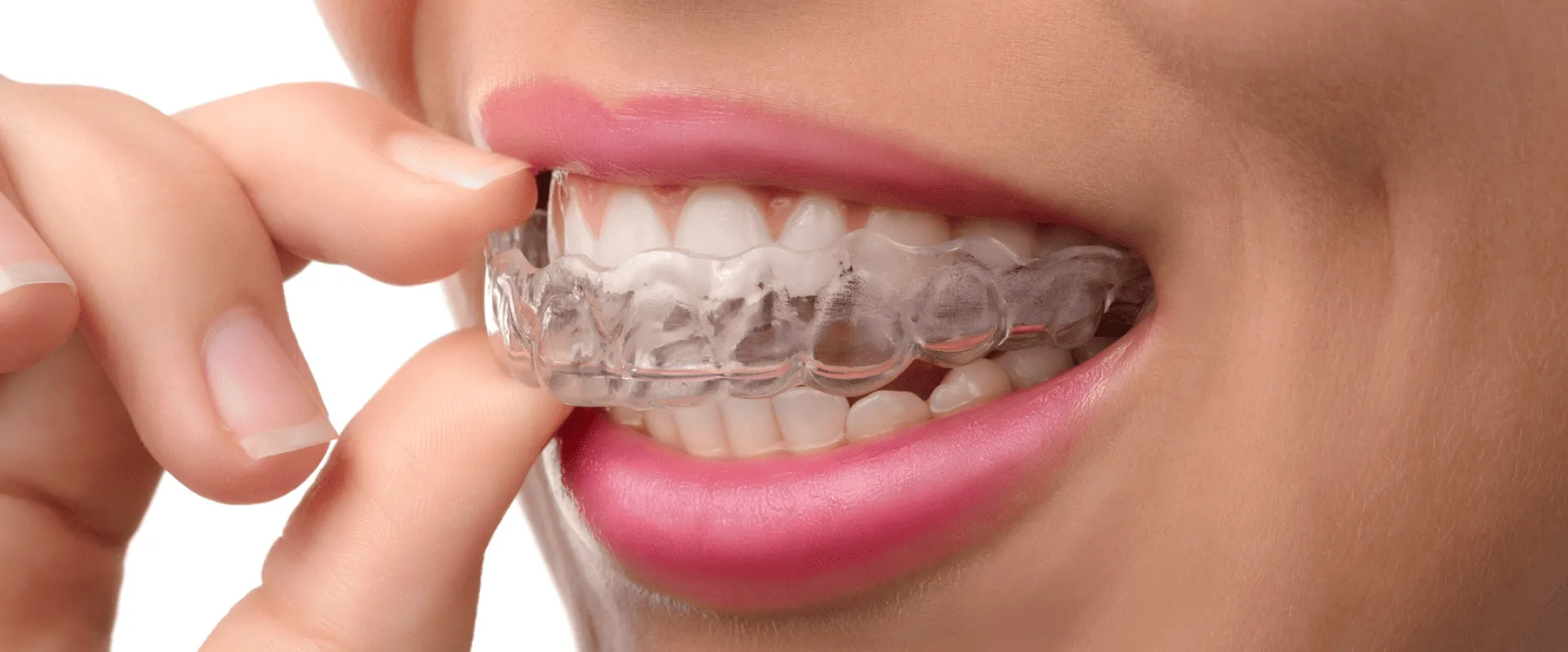Dra. Rúbia Lorena - Dentista em Goiânia - Postagem no Blog - 0003