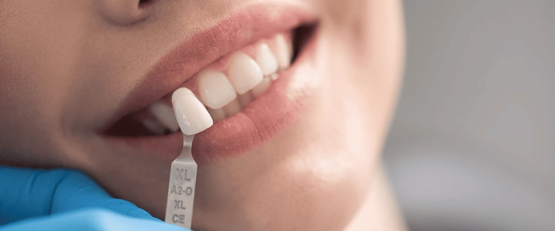 Dra. Rúbia Lorena - Dentista em Goiânia - Postagem no Blog - 0004